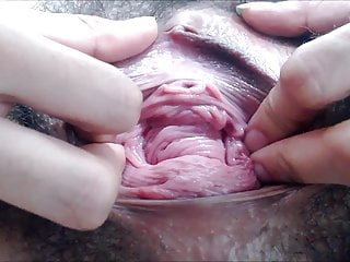 Vaginal Prolapse, Cock, Most Cum Ever, Cunt Cum