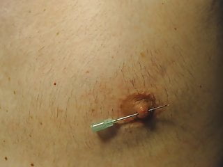 Nipple needle pain...
