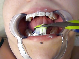Probing, Patient, Mouth, HD Videos