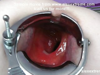 Extreme Insertions, Speculum, Rough Anal Sex, Inserted