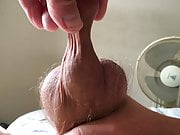 Foreskin with ball - 2 of 4 