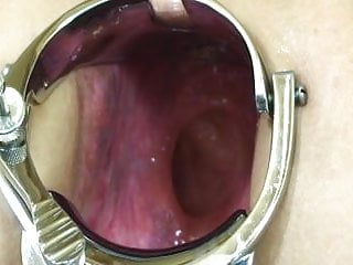 Elmer&#039;s Wife Extreme Speclum - Anal Gape!- kak1