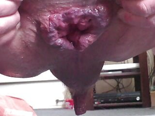 Close up anal gape block of...